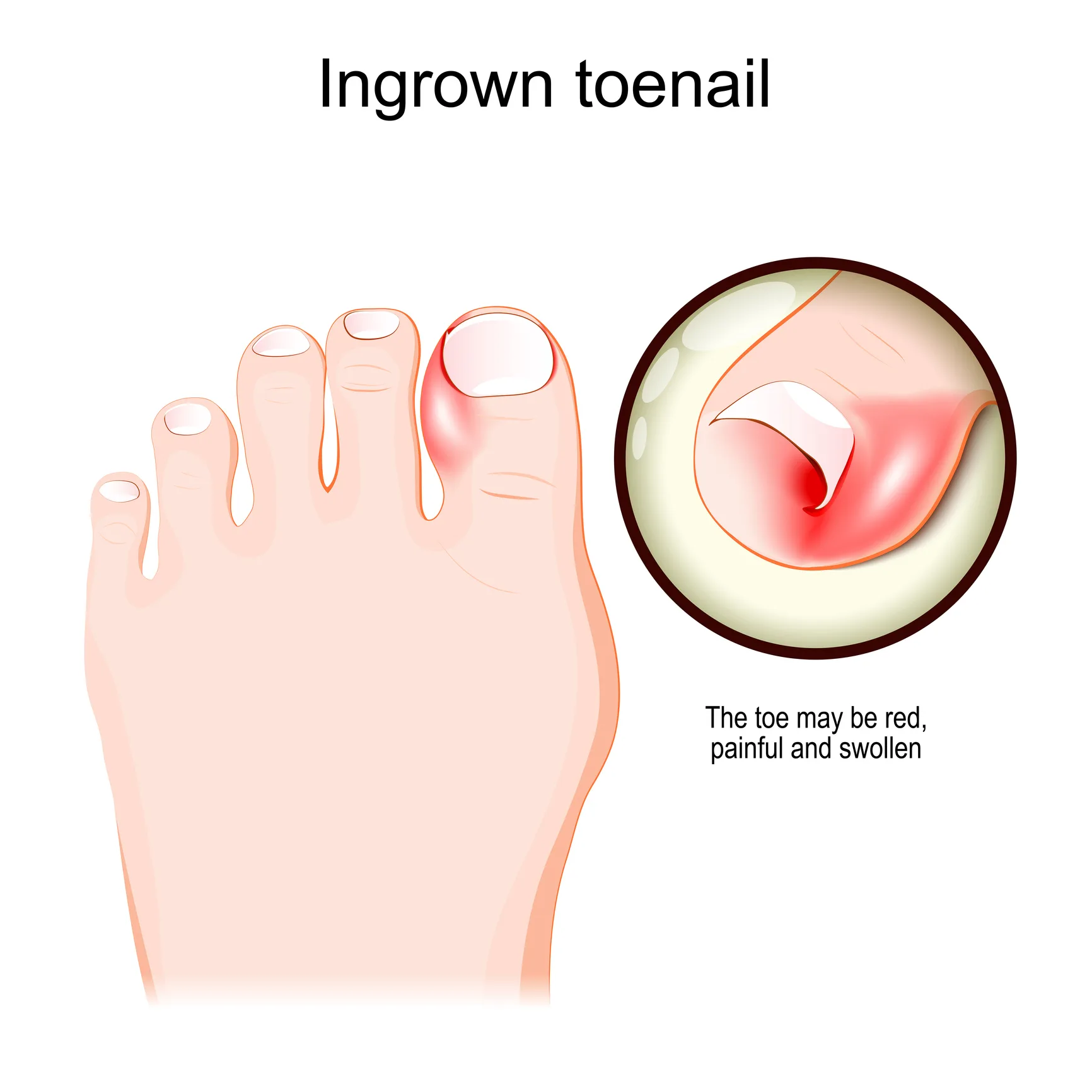Skin & Nail Conditions